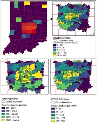 Variation in COVID-19 Diagnosis by Zip Code and Race and Ethnicity in Indiana